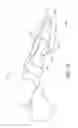 Fig. 05 - ORTHOTIC DEVICES