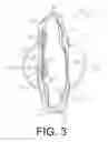Fig. 03 - EXTERNAL LIGHTING FOR BAG IDENTIFICATION