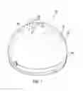 Fig. 02 - Cooking Assembly