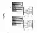 Fig. 10 - Deep optical imaging of tissue with less scattering in the second, third and fourth NIR spectral windows using supercontinuum and other laser coherent light sources