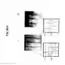 Fig. 12 - Deep optical imaging of tissue with less scattering in the second, third and fourth NIR spectral windows using supercontinuum and other laser coherent light sources
