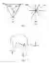 Fig. 03 - Method and system for vector analysis of electrocardiograms