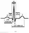 Fig. 04 - Method and system for vector analysis of electrocardiograms
