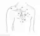 Fig. 01 - Assessing intra-cardiac activation patterns and electrical dyssynchrony