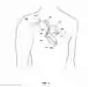 Fig. 02 - Assessing intra-cardiac activation patterns and electrical dyssynchrony