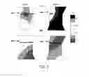 Fig. 08 - Assessing intra-cardiac activation patterns and electrical dyssynchrony
