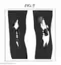 Fig. 06 - Magnetic resonance imaging system and magnetic resonance imaging method