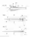 Fig. 04 - Self-Condensing pH Sensor and/or Pepsin Sensor and Catheter Apparatus