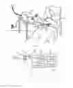 Fig. 02 - WIRELESS SENSOR AND SYSTEM FOR MANAGING FETAL AND MATERNAL DATA OF SUBJECT