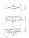 Fig. 03 - Percutaneous atrial and ventricular septal defect closure device