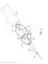 Fig. 07 - Percutaneous atrial and ventricular septal defect closure device