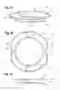 Fig. 15 - Surgical apparatus and method of use thereof