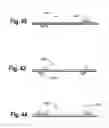 Fig. 19 - Surgical apparatus and method of use thereof