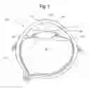 Fig. 02 - Surgical apparatus and method of use thereof
