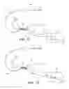 Fig. 03 - Apparatus for mitral valve repair and methods thereof