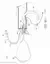 Fig. 05 - Apparatus for mitral valve repair and methods thereof