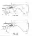 Fig. 09 - Apparatus for mitral valve repair and methods thereof