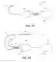 Fig. 13 - Apparatus for mitral valve repair and methods thereof