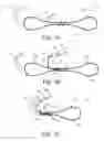 Fig. 15 - Apparatus for mitral valve repair and methods thereof