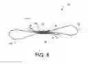 Fig. 16 - Apparatus for mitral valve repair and methods thereof