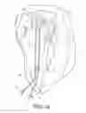 Fig. 20 - Apparatus for mitral valve repair and methods thereof