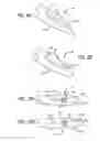 Fig. 05 - Latching anchor device
