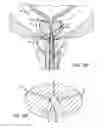 Fig. 11 - Latching anchor device