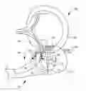 Fig. 01 - Suturing backstop for minimally invasive surgery
