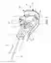 Fig. 04 - Suturing backstop for minimally invasive surgery
