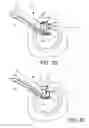 Fig. 08 - Suturing backstop for minimally invasive surgery