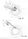 Fig. 09 - Suturing backstop for minimally invasive surgery