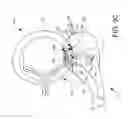 Fig. 16 - Suturing backstop for minimally invasive surgery