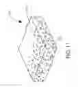 Fig. 12 - Implantable layers for a surgical instrument
