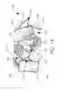 Fig. 15 - Implantable layers for a surgical instrument