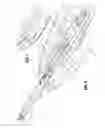 Fig. 05 - Apparatus for applying surgical clips