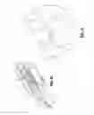 Fig. 13 - Apparatus for applying surgical clips