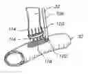 Fig. 01 - Surgical stapler for aortic anastomosis