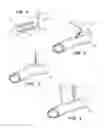 Fig. 02 - Surgical stapler for aortic anastomosis