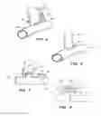 Fig. 03 - Surgical stapler for aortic anastomosis