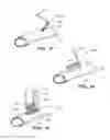 Fig. 07 - Surgical stapler for aortic anastomosis