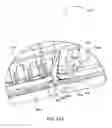 Fig. 102 - Surgical stapler for aortic anastomosis