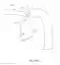 Fig. 138 - Surgical stapler for aortic anastomosis
