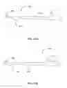Fig. 17 - Surgical stapler for aortic anastomosis