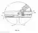 Fig. 20 - Surgical stapler for aortic anastomosis