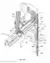 Fig. 23 - Surgical stapler for aortic anastomosis
