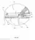 Fig. 28 - Surgical stapler for aortic anastomosis