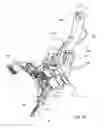 Fig. 30 - Surgical stapler for aortic anastomosis