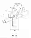 Fig. 46 - Surgical stapler for aortic anastomosis
