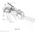 Fig. 47 - Surgical stapler for aortic anastomosis
