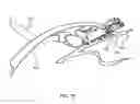 Fig. 49 - Surgical stapler for aortic anastomosis